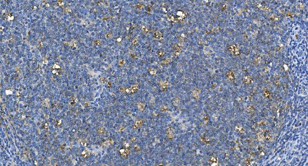 2 - Anti-Carbonic Anhydrase I/CA1 Picoband™ Antibody (monoclonal, 2B5) ABO14995