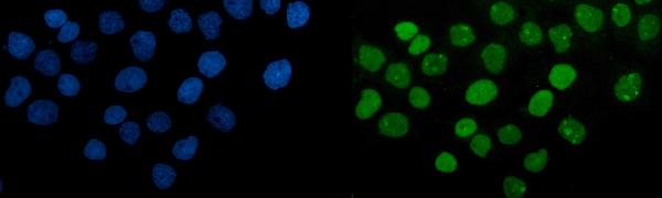 3 - Anti-PARP/PARP1 Picoband™ Antibody (monoclonal, 2I2H4) ABO14997