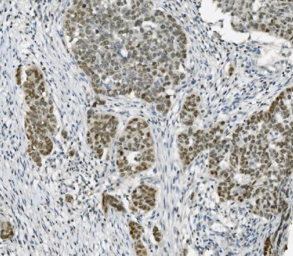 2 - Anti-PARP/PARP1 Picoband™ Antibody (monoclonal, 2I2H4) ABO14997