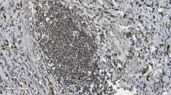 2 - Anti-PARP/PARP1 Picoband™ Antibody (monoclonal, 2I2H4) ABO14997
