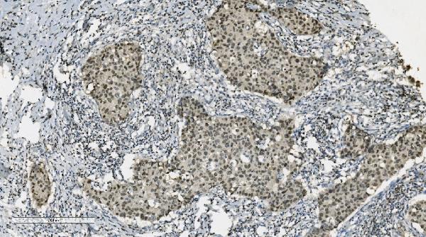 2 - Anti-PARP/PARP1 Picoband™ Antibody (monoclonal, 2I2H4) ABO14997