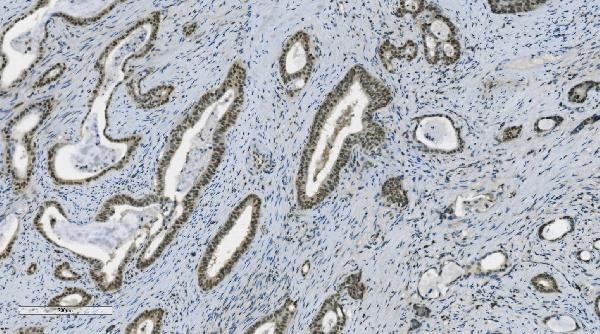 2 - Anti-PARP/PARP1 Picoband™ Antibody (monoclonal, 2I2H4) ABO14997