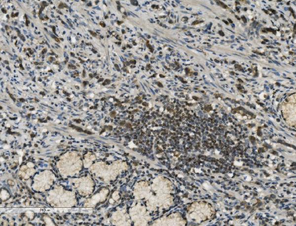 2 - Anti-PARP/PARP1 Picoband™ Antibody (monoclonal, 2I2H4) ABO14997