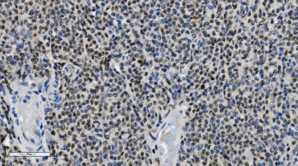 2 - Anti-PARP/PARP1 Picoband™ Antibody (monoclonal, 2I2H4) ABO14997