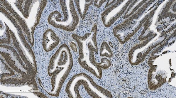 2 - Anti-PARP/PARP1 Picoband™ Antibody (monoclonal, 2I2H4) ABO14997