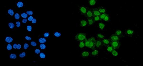 3 - Anti-PARP/PARP1 Picoband™ Antibody (monoclonal, 10E11) ABO14998
