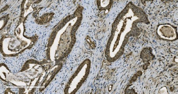 2 - Anti-PARP/PARP1 Picoband™ Antibody (monoclonal, 10E11) ABO14998
