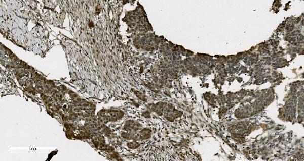 2 - Anti-PARP/PARP1 Picoband™ Antibody (monoclonal, 10E11) ABO14998