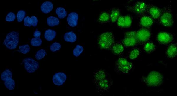 3 - Anti-PARP/PARP1 Picoband™ Antibody (monoclonal, 10G9) ABO14999