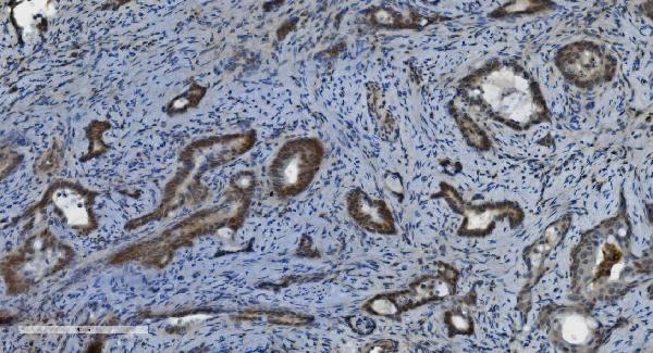 2 - Anti-PARP/PARP1 Picoband™ Antibody (monoclonal, 10G9) ABO14999