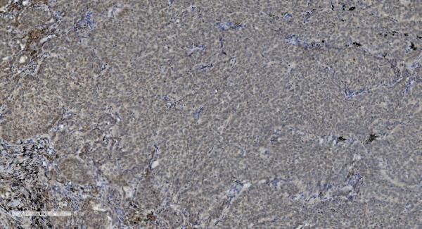 2 - Anti-PARP/PARP1 Picoband™ Antibody (monoclonal, 10G9) ABO14999