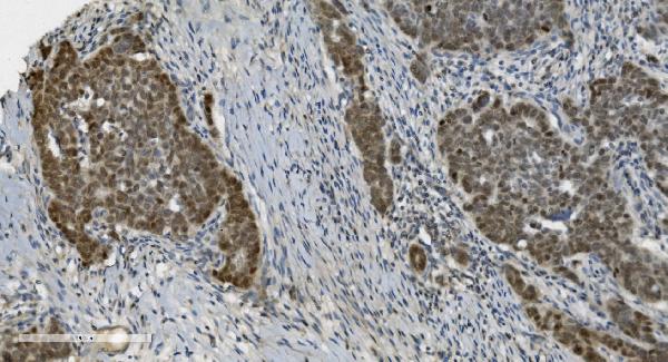 2 - Anti-PARP/PARP1 Picoband™ Antibody (monoclonal, 10G9) ABO14999