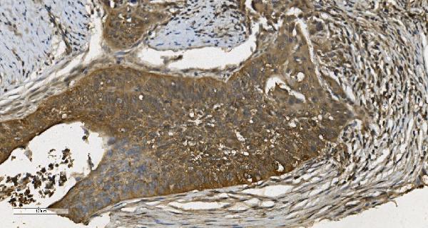 2 - Anti-MPI Picoband™ Antibody (monoclonal, 5G5) ABO15000