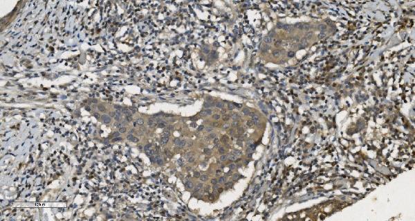 2 - Anti-MPI Picoband™ Antibody (monoclonal, 5G5) ABO15000