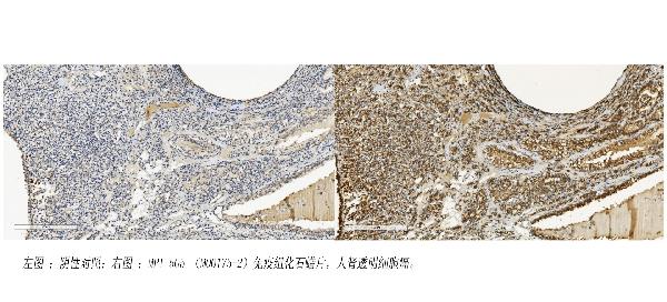 2 - Anti-MPI Picoband™ Antibody (monoclonal, 5G5) ABO15000