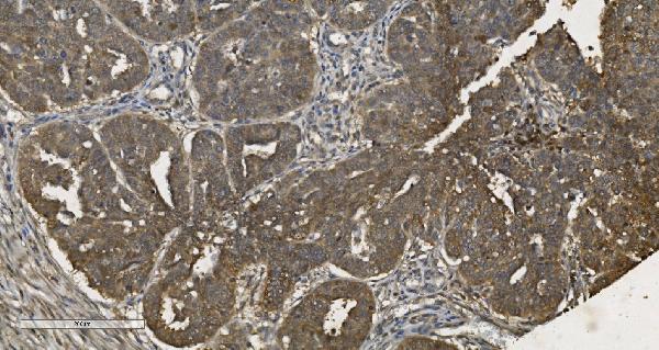 2 - Anti-MPI Picoband™ Antibody (monoclonal, 5G5) ABO15000