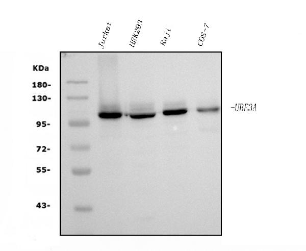 1 - Anti-UBE3A Picoband™ Antibody (monoclonal, 3F13) ABO15001