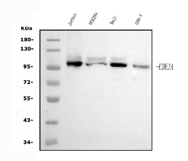 1 - Anti-UBE3A Picoband™ Antibody (monoclonal, 8I3) ABO15002