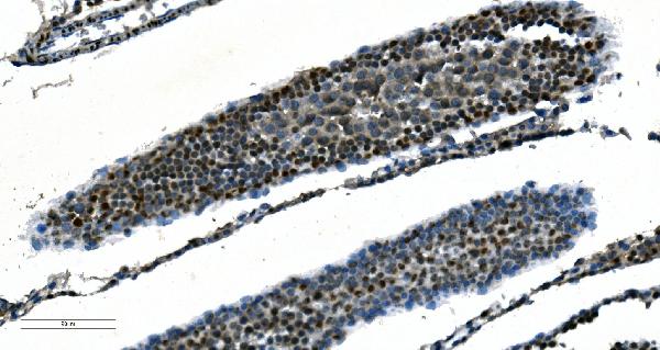 2 - Anti-CDC45L Picoband™ Antibody (monoclonal, 6H6) ABO15004