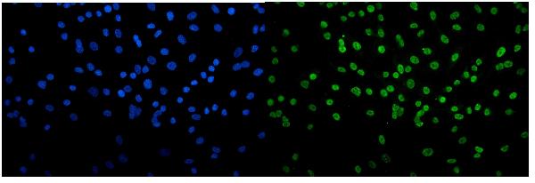 3 - Anti-Transketolase/TKT Picoband™ Antibody (monoclonal, 3E5) ABO15005