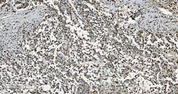 2 - Anti-Transketolase/TKT Picoband™ Antibody (monoclonal, 3E5) ABO15005