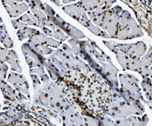 2 - Anti-Transketolase/TKT Picoband™ Antibody (monoclonal, 3E5) ABO15005