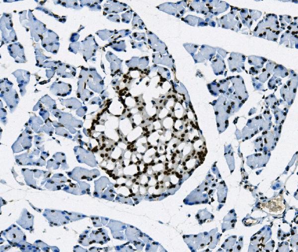 2 - Anti-Transketolase/TKT Picoband™ Antibody (monoclonal, 3E5) ABO15005