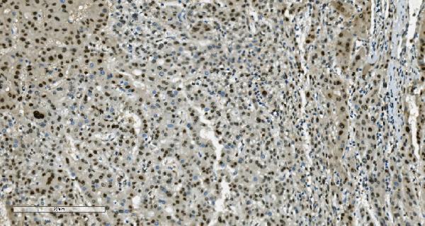 2 - Anti-Transketolase/TKT Picoband™ Antibody (monoclonal, 3E5) ABO15005