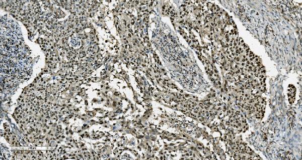 2 - Anti-Transketolase/TKT Picoband™ Antibody (monoclonal, 3E5) ABO15005