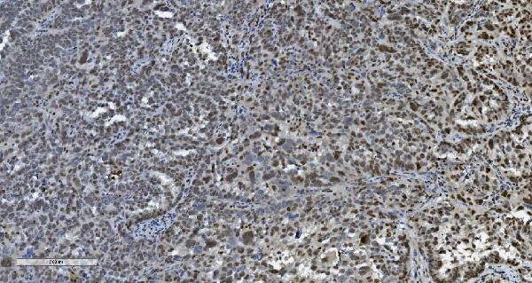 2 - Anti-Transketolase/TKT Picoband™ Antibody (monoclonal, 3E5) ABO15005