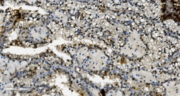 2 - Anti-Transketolase/TKT Picoband™ Antibody (monoclonal, 3E5) ABO15005