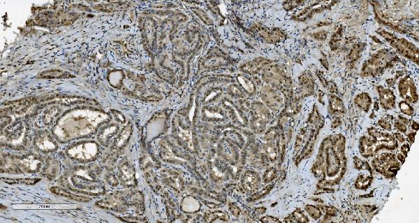 2 - Anti-Transketolase/TKT Picoband™ Antibody (monoclonal, 3E5) ABO15005