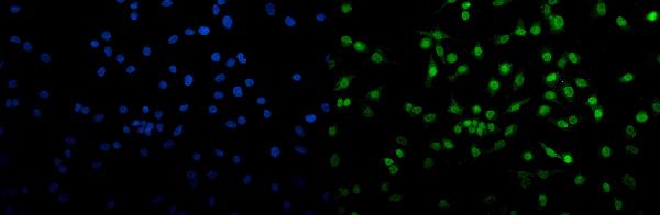 3 - Anti-Transketolase/TKT Picoband™ Antibody (monoclonal, 2I3) ABO15006