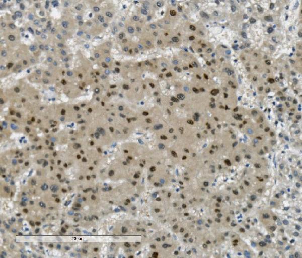 2 - Anti-Transketolase/TKT Picoband™ Antibody (monoclonal, 2I3) ABO15006