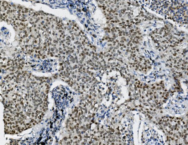 2 - Anti-Transketolase/TKT Picoband™ Antibody (monoclonal, 2I3) ABO15006