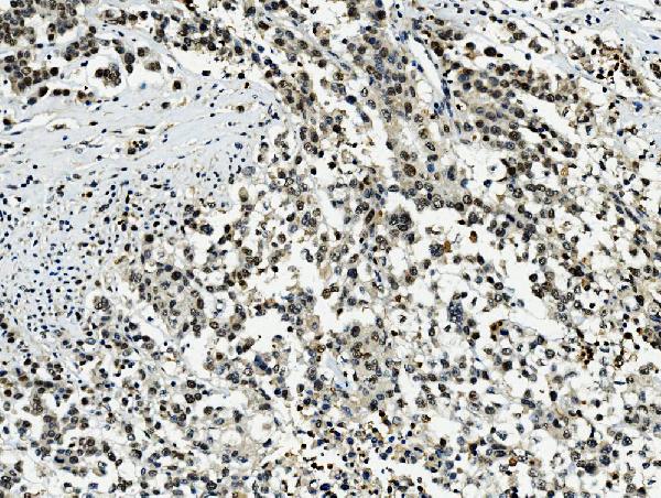 2 - Anti-Transketolase/TKT Picoband™ Antibody (monoclonal, 2I3) ABO15006