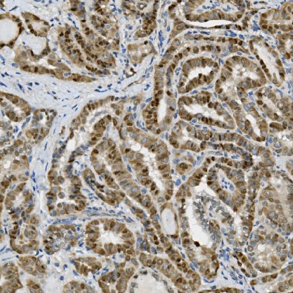 2 - Anti-Transketolase/TKT Picoband™ Antibody (monoclonal, 2I3) ABO15006
