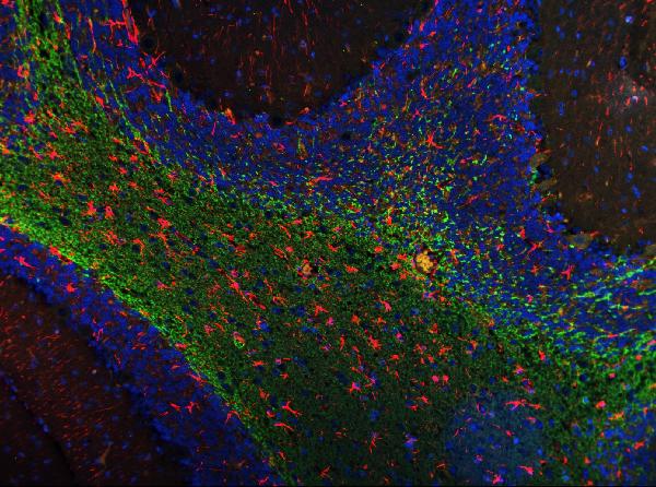 3 - Anti-MAG Picoband™ Antibody (monoclonal, 2G11) ABO15007