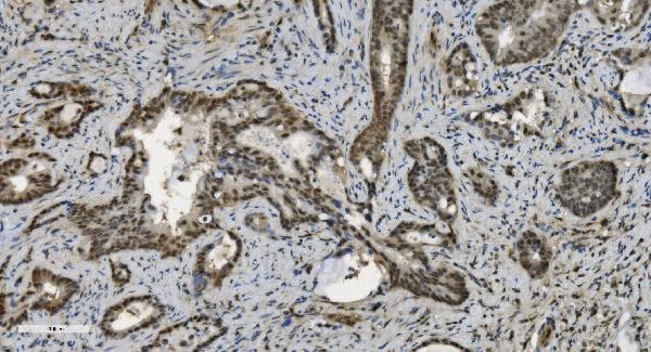 2 - Anti-U2AF65/U2AF2 Picoband™ Antibody (monoclonal, 10F4) ABO15008