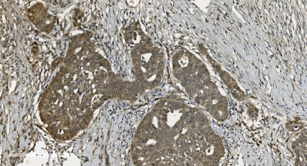 2 - Anti-U2AF65/U2AF2 Picoband™ Antibody (monoclonal, 10F4) ABO15008