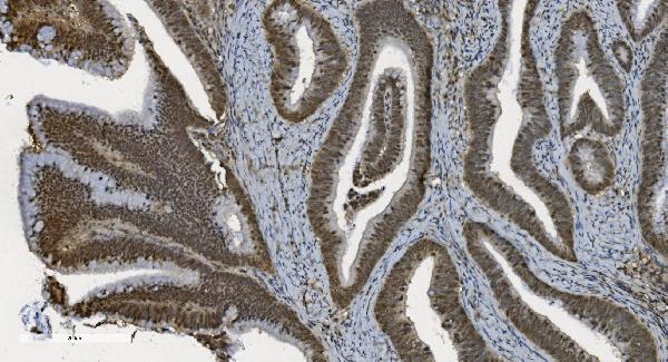 2 - Anti-U2AF65/U2AF2 Picoband™ Antibody (monoclonal, 10F4) ABO15008