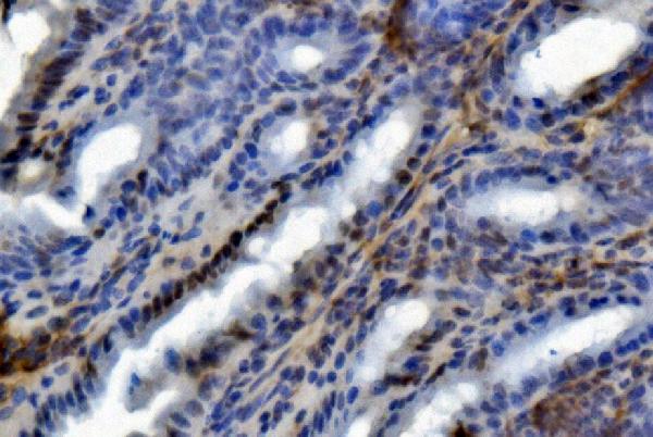 2 - Anti-U2AF65/U2AF2 Picoband™ Antibody (monoclonal, 10F4) ABO15008