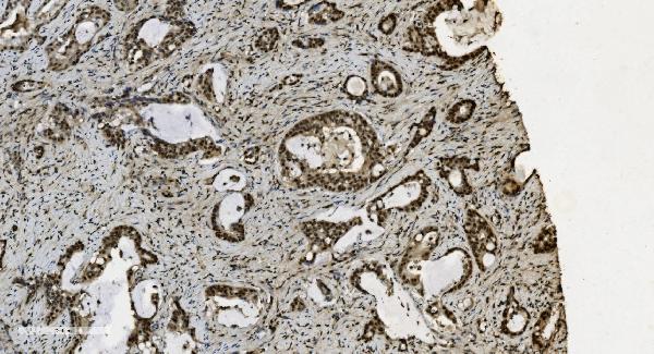 2 - Anti-U2AF65/U2AF2 Picoband™ Antibody (monoclonal, 3G9) ABO15009