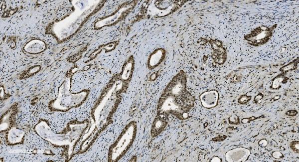 2 - Anti-U2AF65/U2AF2 Picoband™ Antibody (monoclonal, 3G9) ABO15009