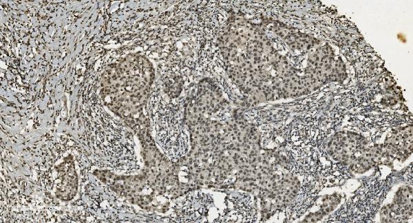 2 - Anti-U2AF65/U2AF2 Picoband™ Antibody (monoclonal, 3G9) ABO15009