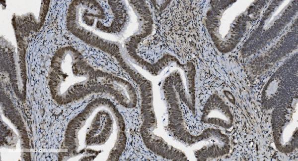 2 - Anti-U2AF65/U2AF2 Picoband™ Antibody (monoclonal, 3G9) ABO15009