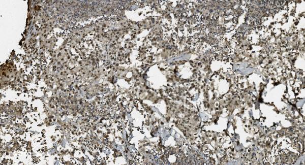 2 - Anti-U2AF65/U2AF2 Picoband™ Antibody (monoclonal, 3G9) ABO15009