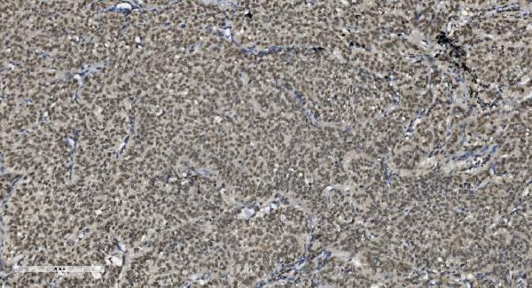 2 - Anti-U2AF65/U2AF2 Picoband™ Antibody (monoclonal, 3G9) ABO15009