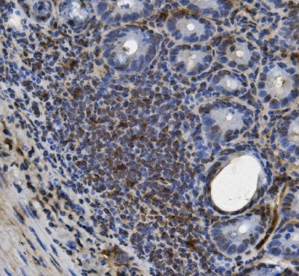 2 - Anti-U2AF65/U2AF2 Picoband™ Antibody (monoclonal, 3G9) ABO15009
