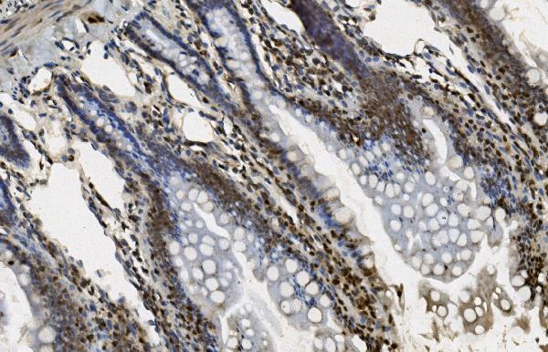 2 - Anti-U2AF65/U2AF2 Picoband™ Antibody (monoclonal, 3G9) ABO15009
